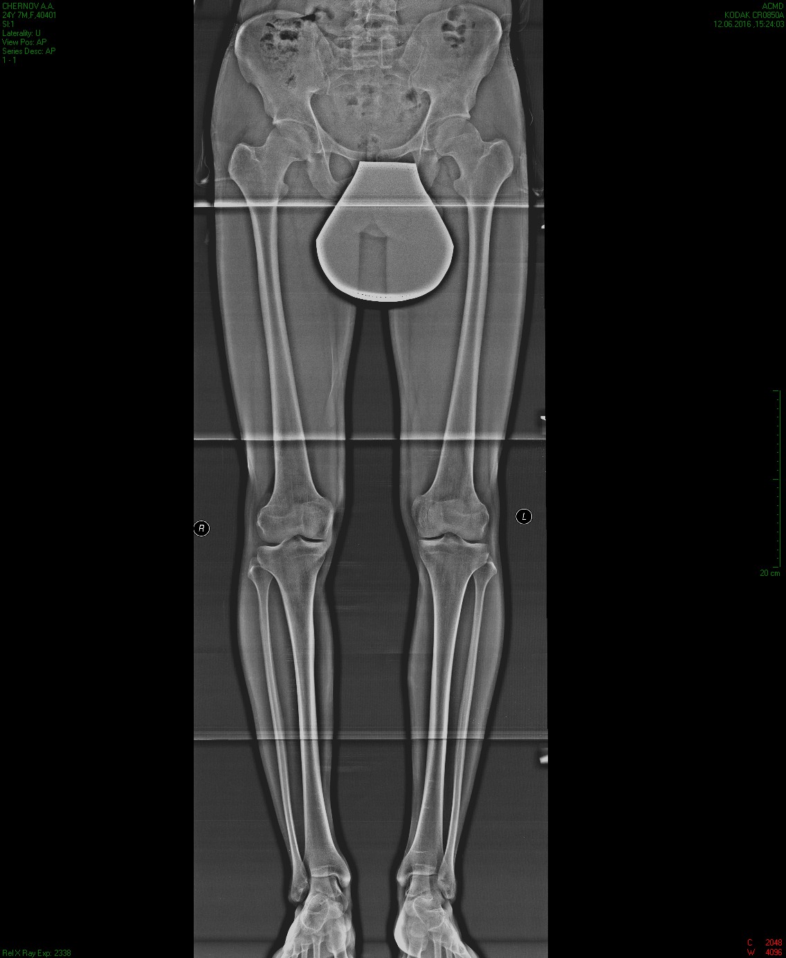 Slot рентген нижних конечностей